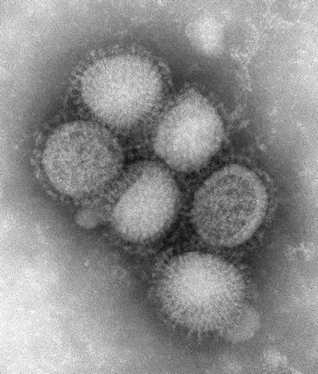 Flu virus -- the real thing -- photographed by the CDC.