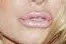 jessica-simpson-lips-botox-maybe Jessica Simpson lips.