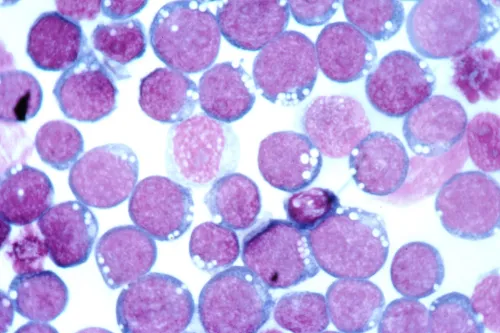 Epstein-Barr virus. Public domain photo courtesy of the National Cancer Institute.